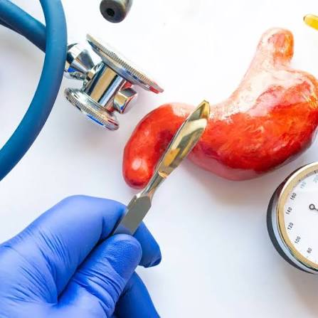 Bariatric surgery consultation