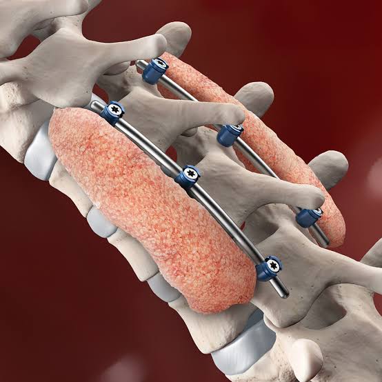 Spine surgery consultation with imaging